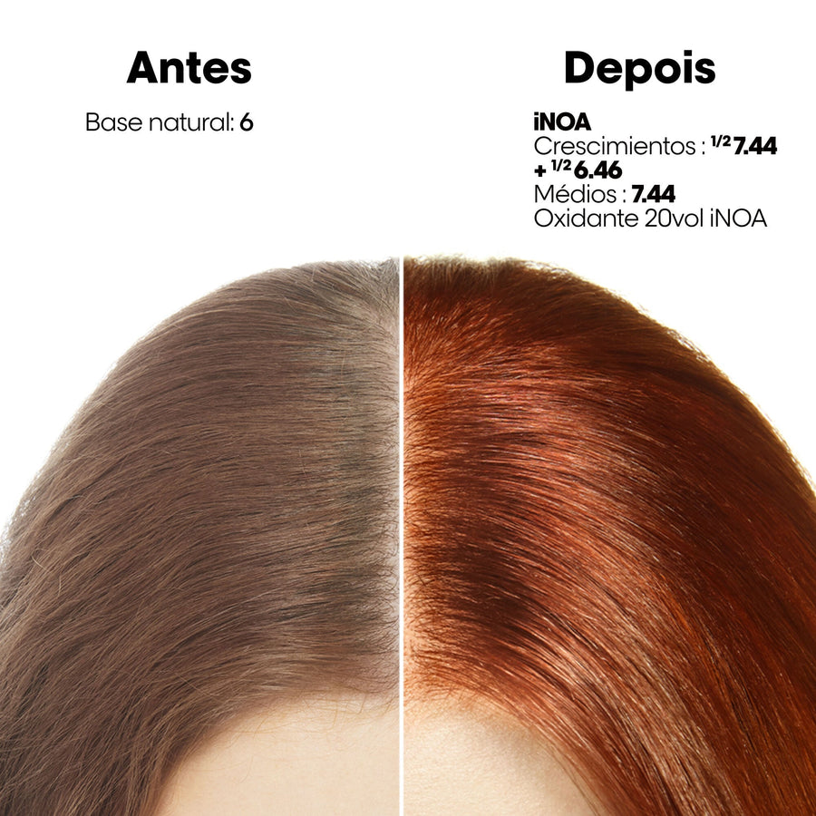 Antes e depois da iNOA na zona da raiz, base natural 6
