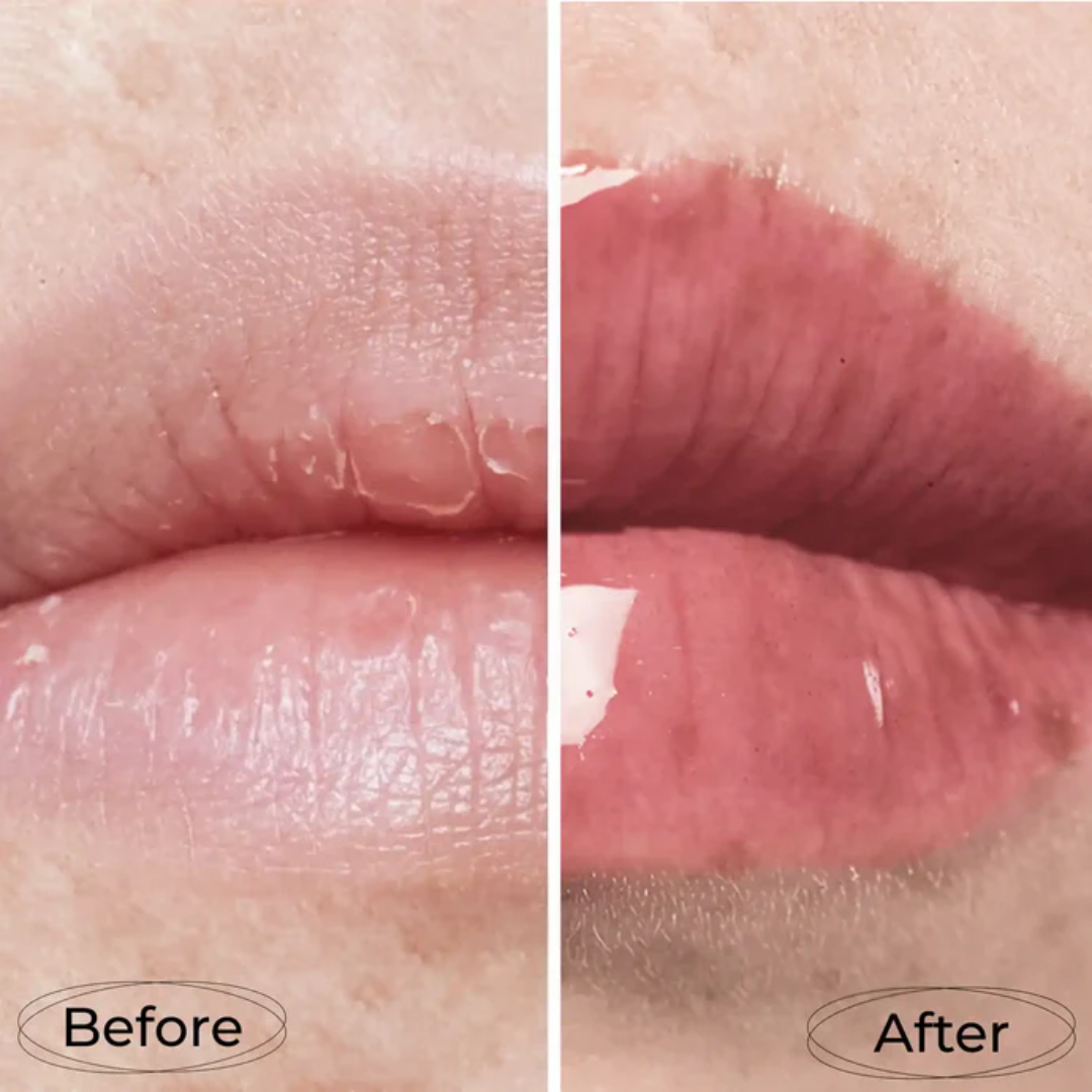 Antes e depois com Lamel Let's Glaze Óleo Labial Hidratante com Brilho 4ml Nº 404