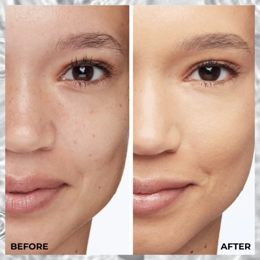 Antes e depois com Lamel Smart Skin Base Sérum com Cor e Ácido Hialurónico 35ml Nº 401